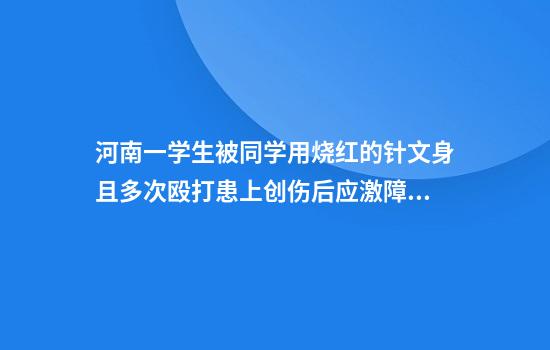 河南一学生被同学用烧红的针文身且多次殴打患上创伤后应激障碍症