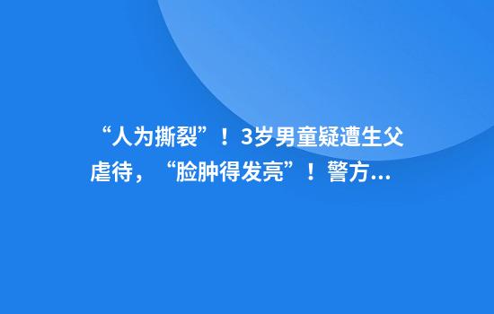 “人为撕裂”！3岁男童疑遭生父虐待，“脸肿得发亮”！警方已立案