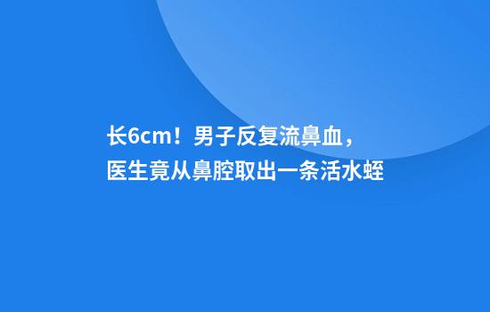 长6cm！男子反复流鼻血，医生竟从鼻腔取出一条活水蛭