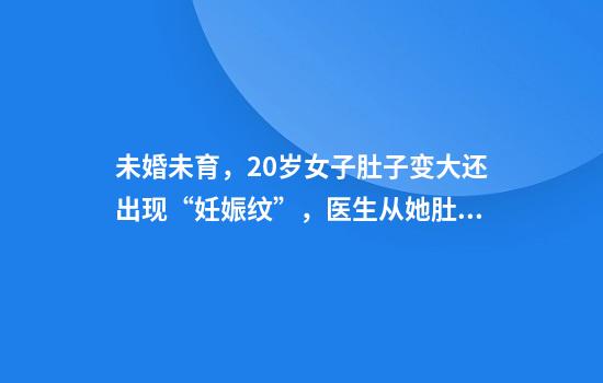 未婚未育，20岁女子肚子变大还出现“妊娠纹”，医生从她肚子里取出10公斤重肿瘤